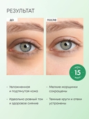 Патчи для кожи вокруг глаз 