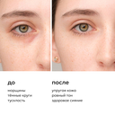 Гель для кожи вокруг глаз 