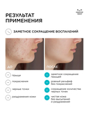 Стик для лица точечного действия 