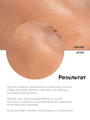 Сыворотка для лица 