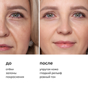 Лимфодренажная криомаска для лица 