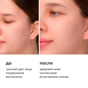 Пенка для умывания кожи лица 